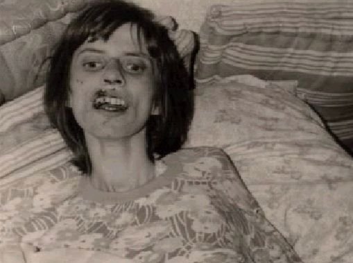 Anneliese Michel zemřela 1. července 1976 v důsledku dehydratace a podvýživy. Tělo Anneliese vážilo 31 kilogramů.