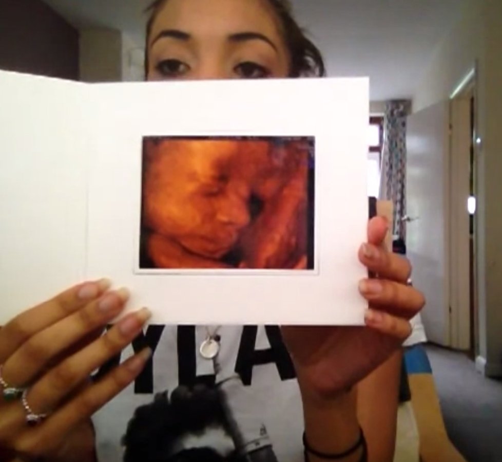Holly ukazuje snímek nenarozené dcerky. Podle doktorů je zdravá.