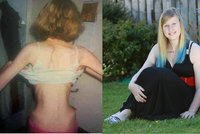 Děsivá zpověď anorektičky: Až na smrtelné posteli mi došlo, že chci žít!