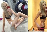 Anorektička (17) vyhladověla kvůli popularitě na 35 kilo. Od smrti ji dělily hodiny