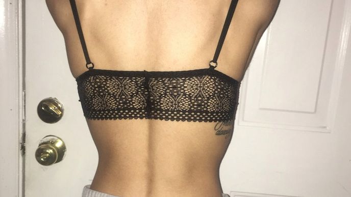 Trpěla anorexií a vážila děsivých 36 kilogramů! Trpěla anorexií a vážila děsivých 36 kilogramů!
