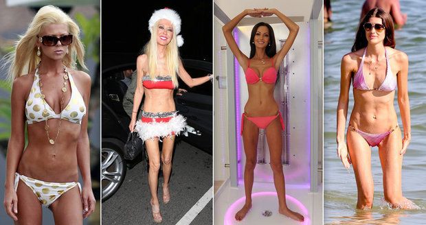Slavné anorektičky: Na kost vyhubly Angelina Jolie, Victoria Beckham i Eliška Bučková