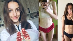 Valerie (21) z Plzně onemocněla anorexií. Svůj příběh popsala v knize.