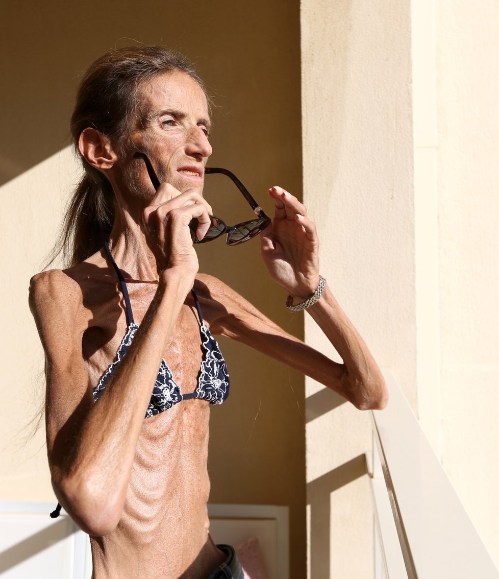 Valeria Levitin (39) je se svými 26,5 kilogramy čtvrtou nejhubenější ženou světa.
