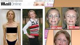 Samantha (38): Vyhrála jsem boj s anorexií!