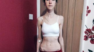 Slyšela lékaře, jak říkají: „Zbývá jí jen pár hodin života“. Neuvěříte, co se stalo dál! Slyšela lékaře, jak říkají: „Zbývá jí jen pár hodin života“. Neuvěříte, co se stalo dál!