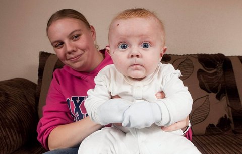 Maminka se nikdy nepomazlí se svým synem: Každý dotyk mu trhá kůži!