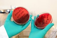 Chyba v laborce se smrtelnými nemocemi: Semdesát vědců se v USA nakazilo anthraxem?!