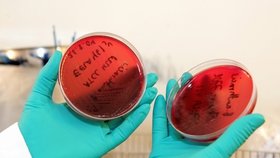 Přes 70 pracovníků americké laboratoře se mohlo nakazit anthraxem (na snímku vzorek sněti slezinné) 