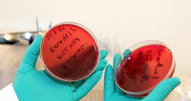 Přes 70 pracovníků americké laboratoře se mohlo nakazit anthraxem (na snímku vzorek sněti slezinné) 