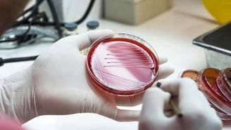 Nové antibiotikum je 25000krát silnější než jeho předchůdce