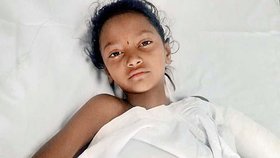 Osmiletá Archana Tale přišla při děsivé nehodě o ruku.