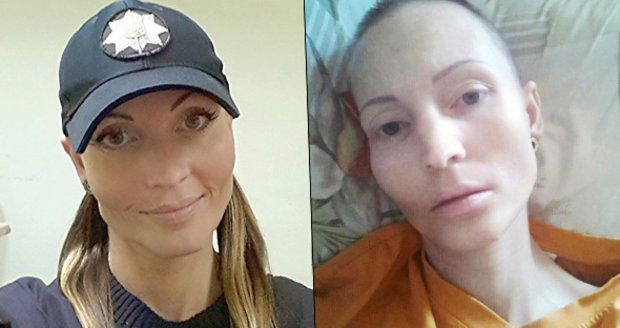 Krásná policajtka zemřela na tuberkulózu poté, co jí plivl do obličeje nakažený kriminálník 