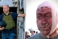 „Přítel Česka“ přežil masakr na pláži v Sydney. Ty šmejdy dostaneme! říká se zkrvavenou hlavou