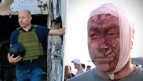 Arsen Ostrovsky: Přežil jsem 7. říjen.