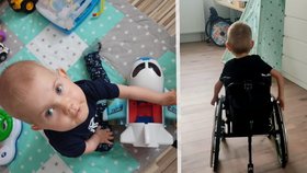 Arturek s SMA po operaci kyčlí opět na vozíku