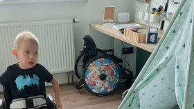 Arturek s SMA po operaci kyčlí opět na vozíku