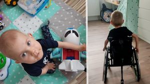 Malý Arturek s SMA: Po operaci kyčlí opět na vozíku