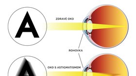 Jak vidí lidé s astigmatismem