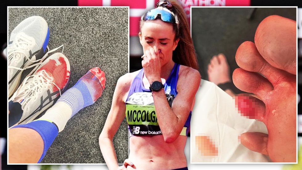 Při Londýnském maratonu skotské běžkyni Eilish McColganové explodoval prst