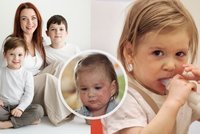 Když kůže mokvá a bolí: Elias (4) a Laura (2) bojují s atopickým ekzémem! Co jim pomáhá?