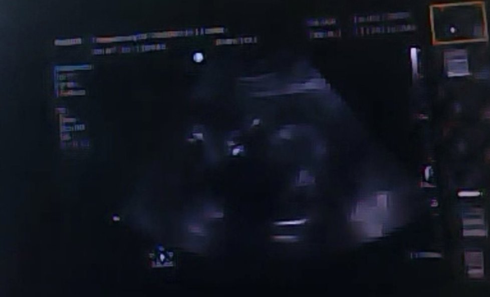 Snímek z ultrazvuku Kaillee Dykeové, která se nakazila koronavirem.