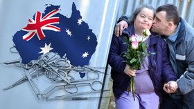 OSN kritizuje Austrálii, země provádí nucené sterilizace lidí s handicapem.
