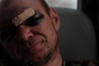 Obličej od krve, místo oka díra. Tým západních chirurgů pomáhá na Ukrajině s rekonstrukcemi obličejů