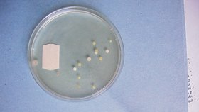 Bakterie rodu Bacillus a další se našly na počítači redaktorky Blesku