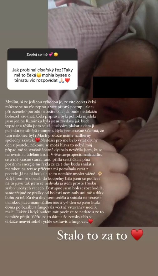 Monika Bagárová na svém instagramu zodpovídala otázky ohledně šestinedělí, kojení i císařského řezu.