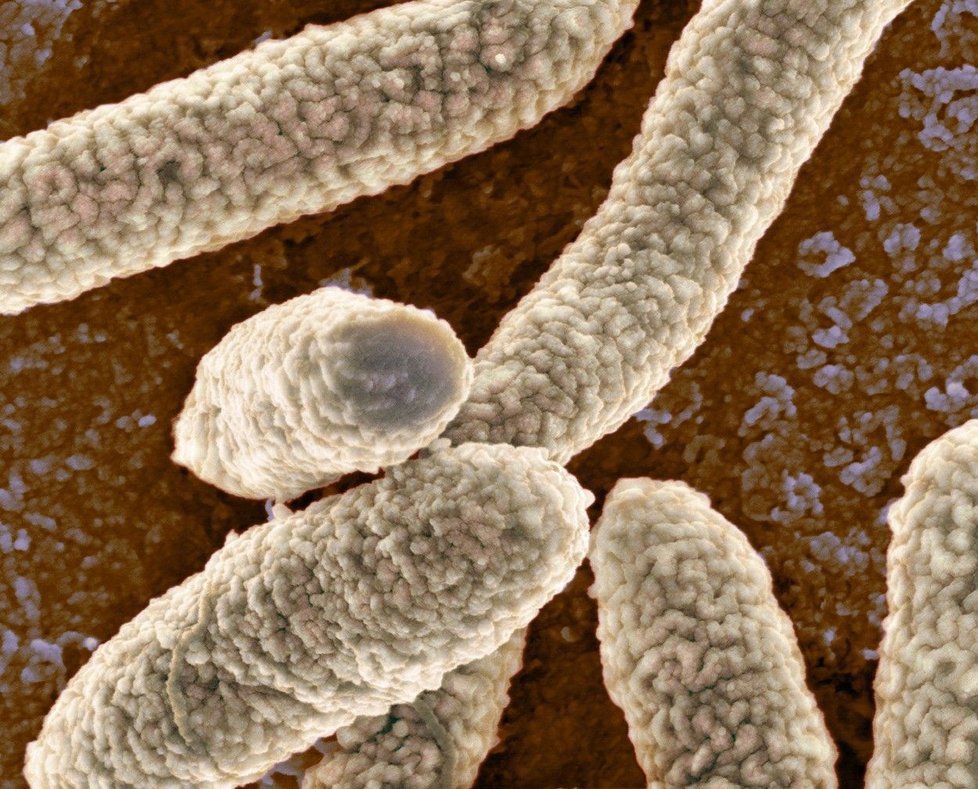 Bakterie E. coli