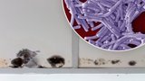 Topíte málo? Zaděláváte si na problémy. Chlad nahrává plísním a bakteriím, varují lékaři