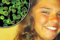 Dívka (12) se nakazila v jezeře: Smrtící prvok jí požírá mozek
