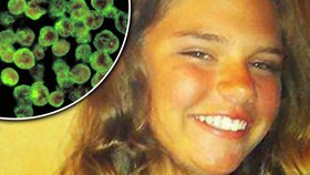Dívka (12) se nakazila v jezeře: Smrtící prvok jí požírá mozek