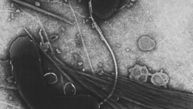 Bakterie vibrio cholerae pod elektronovým mikroskopem.