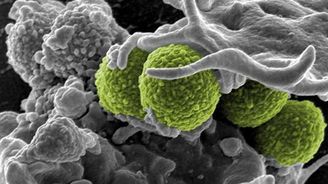 S bakteriální rezistencí k antibiotikům by si mohly poradit syntetické molekuly