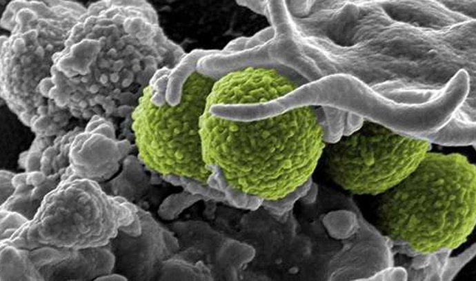 S bakteriální rezistencí k antibiotikům by si mohly poradit syntetické molekuly. Ilustrační foto.