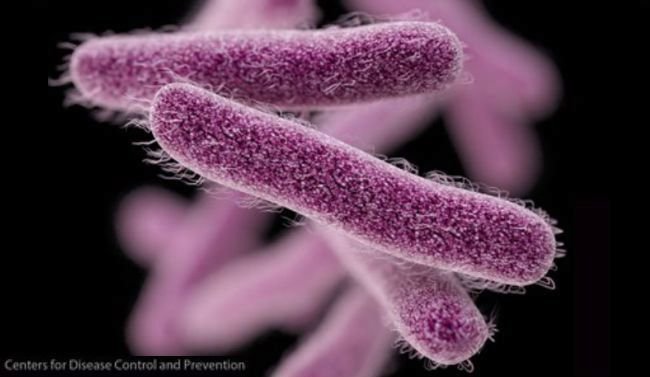 Shigella