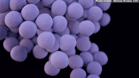 Staphylococcus aureus