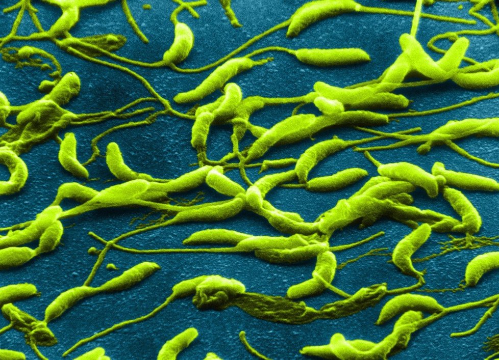 Bakterie a viry zabijí při praní kombinace teploty a pracího prášku. Když je teplota moc nízká, přežijí.