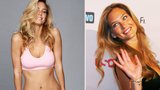 Topmodelka Bar Refaeli propadla "upírskému" liftingu!