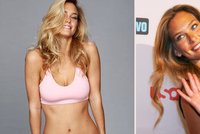 Topmodelka Bar Refaeli propadla "upírskému" liftingu!