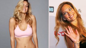 Topmodelka Bar Refaeli propadla "upírskému" liftingu!