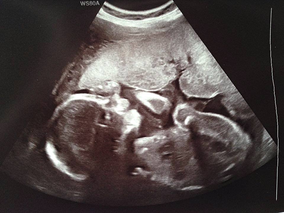 Divišová se v listopadu pochlubila snímkem své prvorozené dcery.