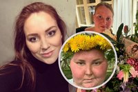 Báru (29) léčba nádoru mozku změnila k nepoznání: Zakletá princezna! Teď napsala knihu...