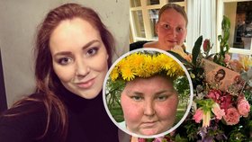 Báru (29) léčba nádoru mozku změnila k nepoznání: Zakletá princezna! Teď napsala knihu...