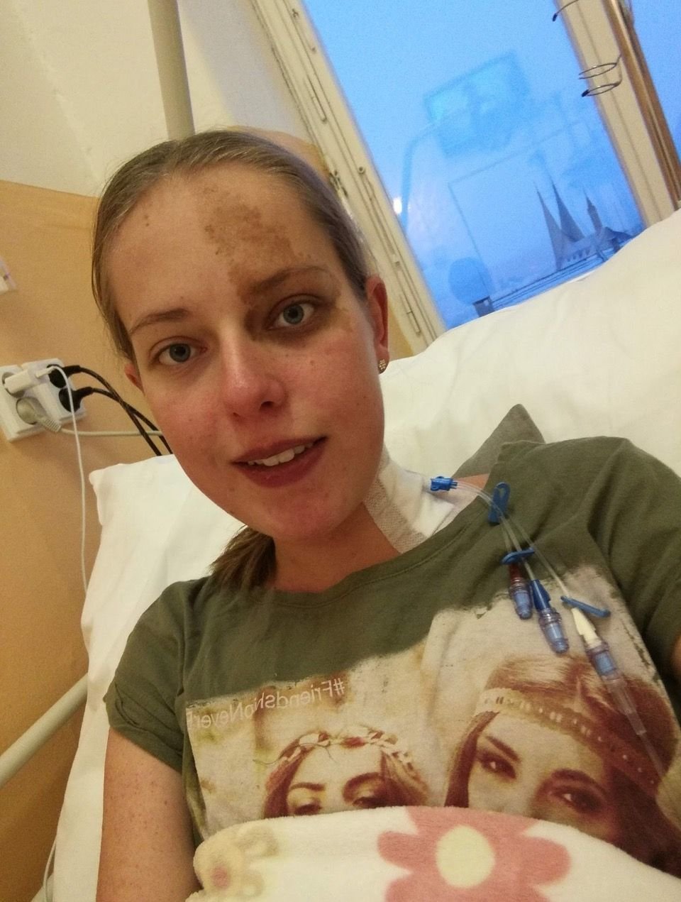 Bára podstoupila transplantaci plic, ta jí zachránila život.