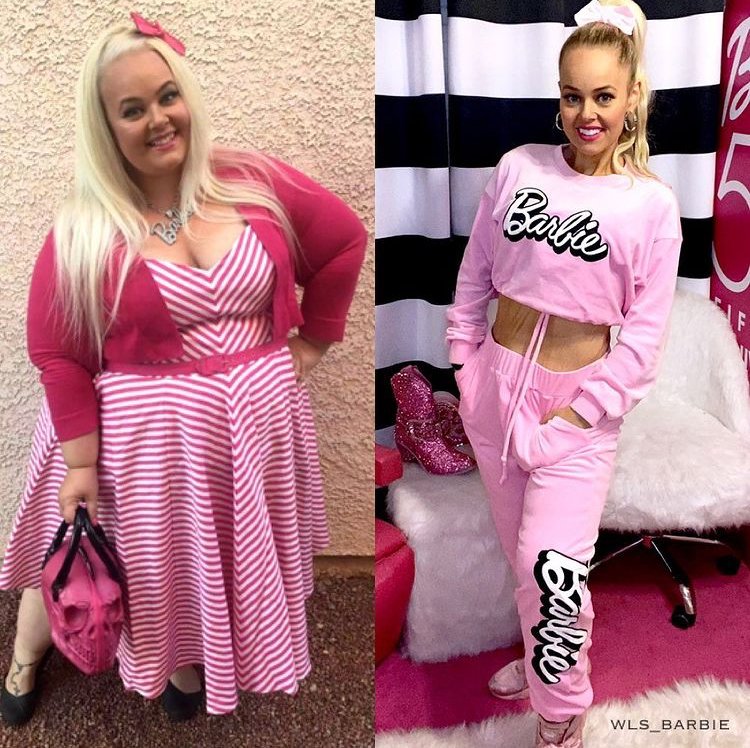 Kayla Lavendeová (36) zhubla 90 kilo poté, co si nechala odstranit 80% svého žaludku.