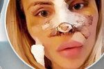 Barbie Jiráčková zavrhla chirurga, který operoval nos Lele Ceterové.