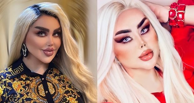 Žena podstoupila 43 operací, aby vypadala jako panenka Barbie. Lidé ji ale nazývají zombie